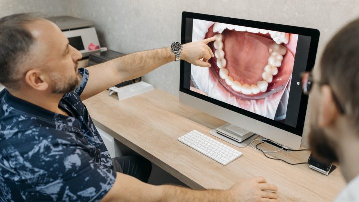 4 Great Reasons Why Dental Implants Are Advantageous